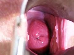 Thin youngster fingered by elder unlicensed gyno doctor