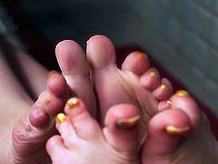 amputee toes