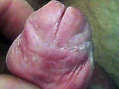 Litle glans