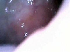 Endoscope inside my anal hole